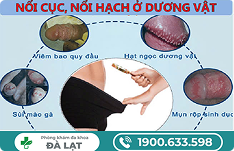 Bài viết nam khoa