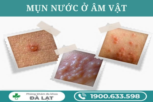 Hình ảnh minh họa