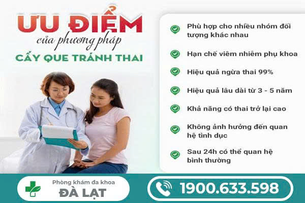 Hình ảnh minh họa