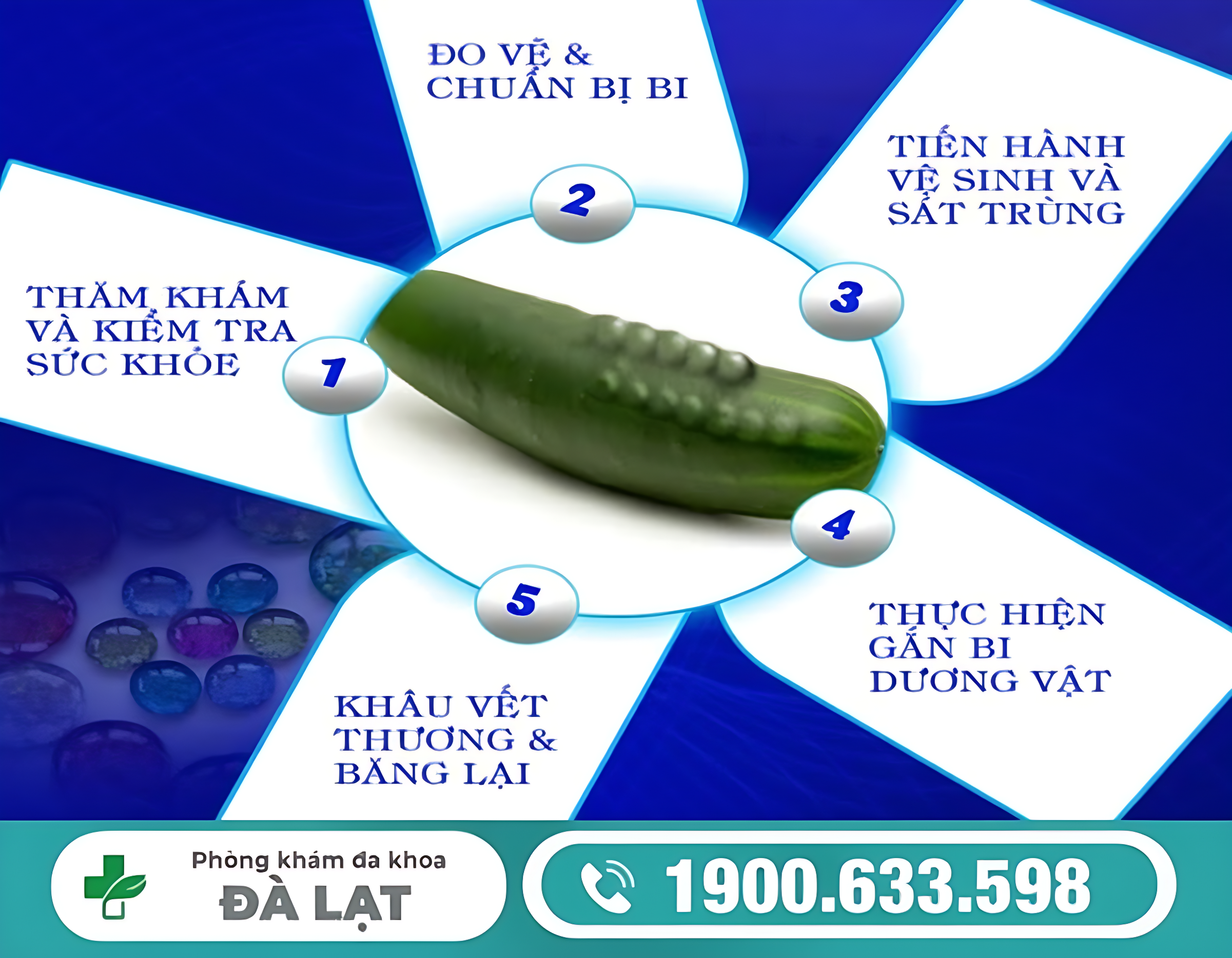 Hình ảnh minh họa