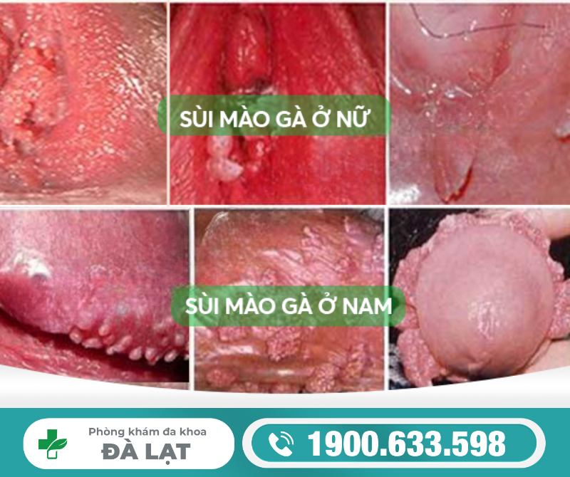 Hình ảnh minh họa