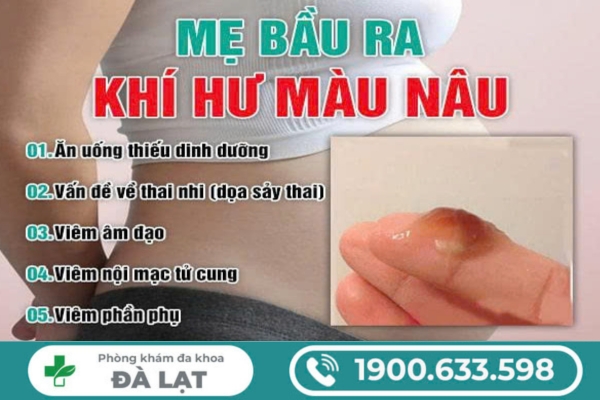 Hình ảnh minh họa