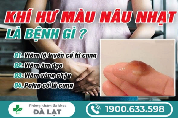 Hình ảnh minh họa