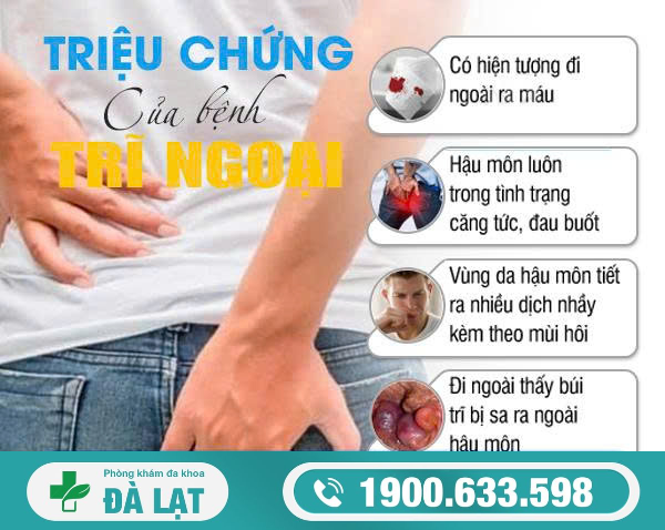 Hình ảnh minh họa