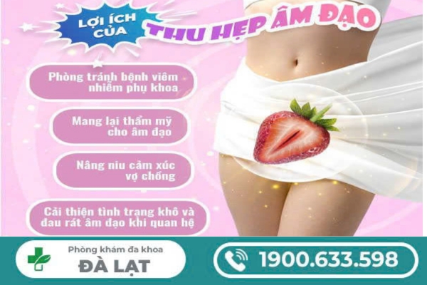 Hình ảnh minh họa