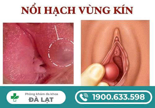 Hình ảnh minh họa