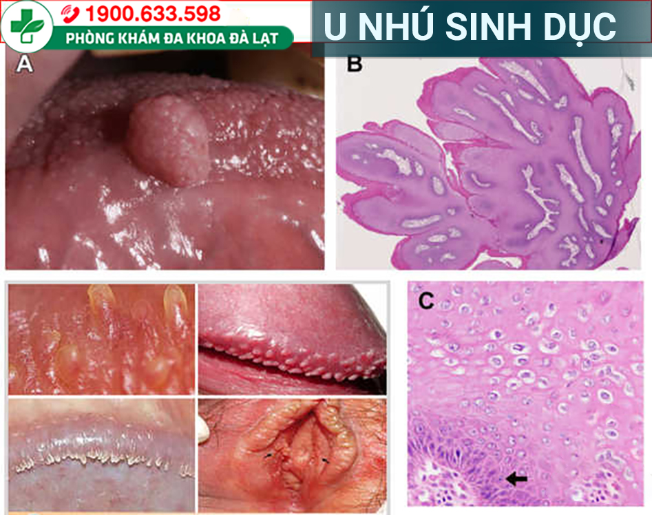 Hình ảnh minh họa