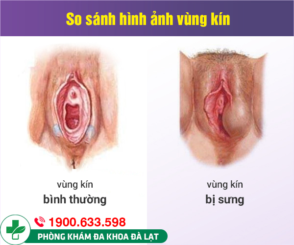 Hình ảnh minh họa
