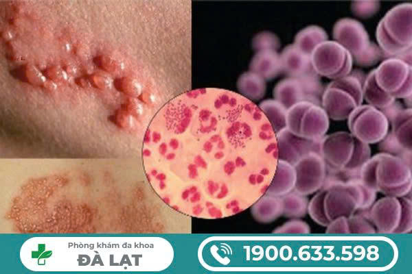 Hình ảnh minh họa