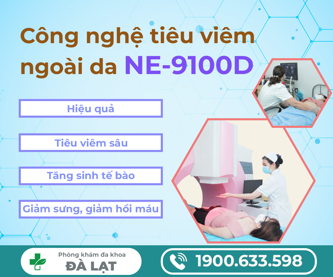 Hình ảnh minh họa