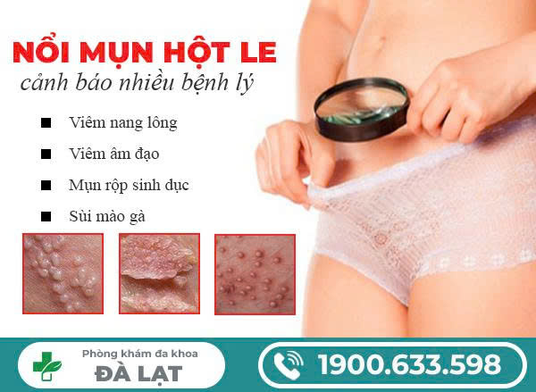 Hình ảnh minh họa