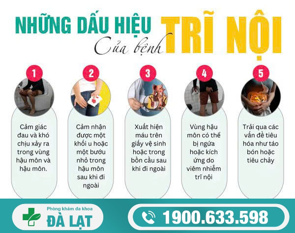 Hình ảnh minh họa