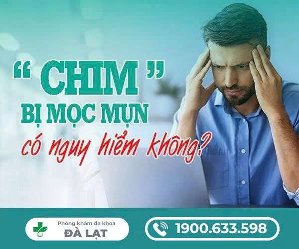 Hình ảnh minh họa