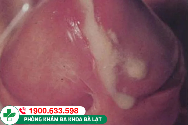 Hình ảnh minh họa