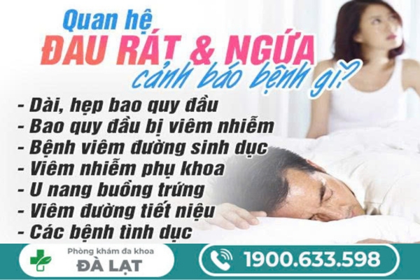 Hình ảnh minh họa