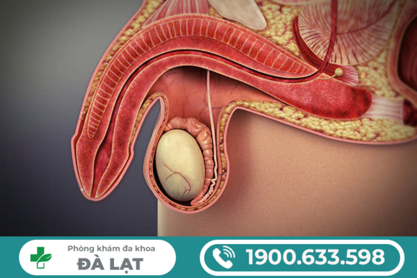 Hình ảnh minh họa