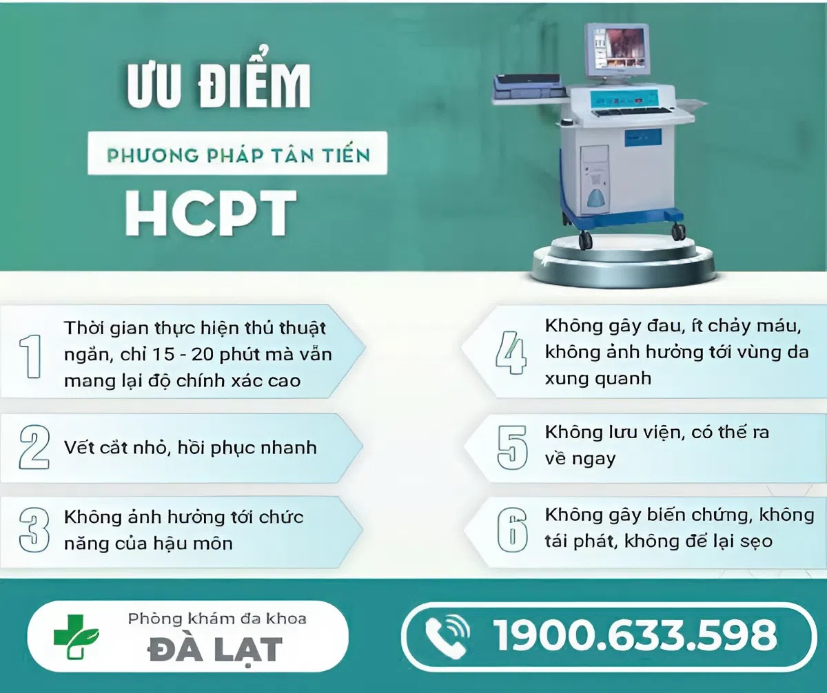 Hình ảnh minh họa