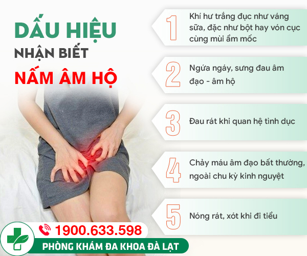 Hình ảnh minh họa