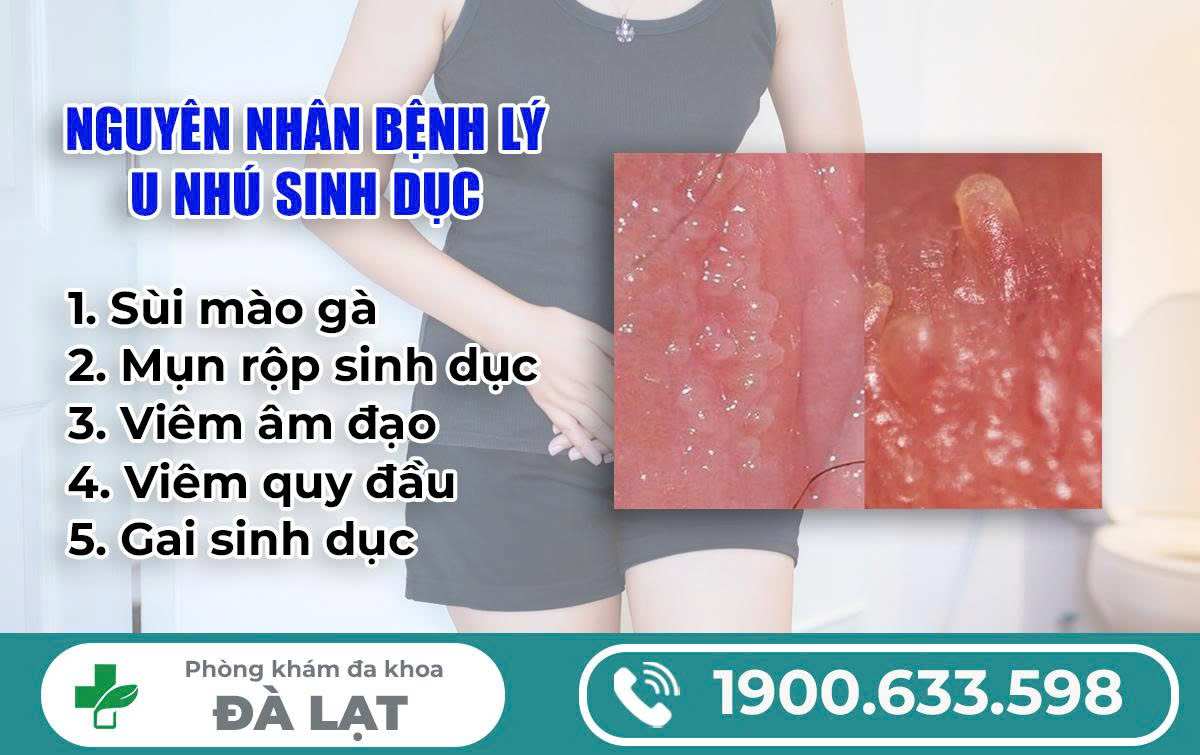 Hình ảnh minh họa