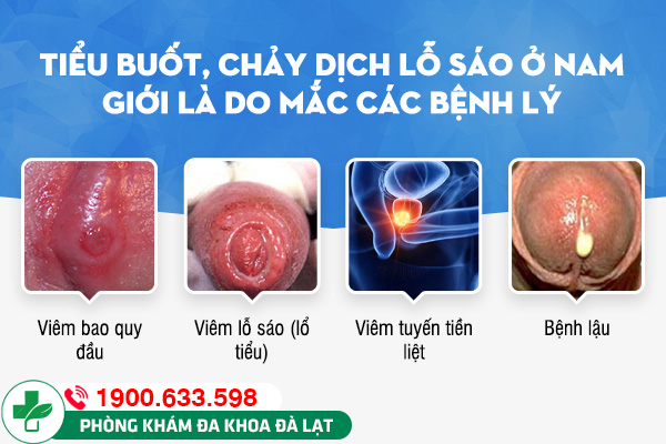 Hình ảnh minh họa