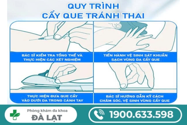 Hình ảnh minh họa