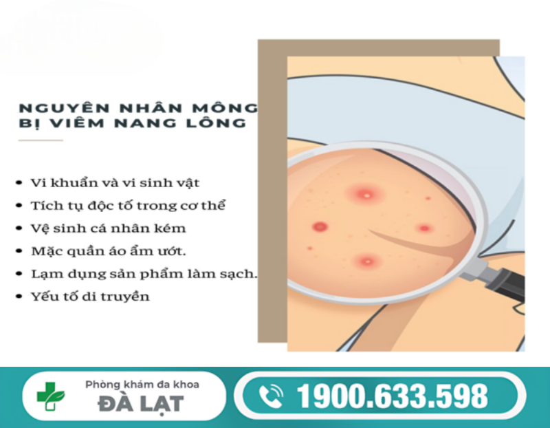 H&igrave;nh ảnh minh họa