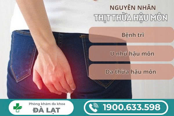 Hình ảnh minh họa