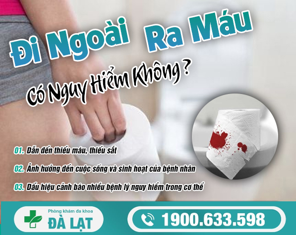 Hình ảnh minh họa