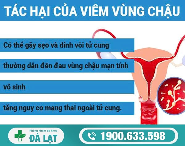 Hình ảnh minh họa