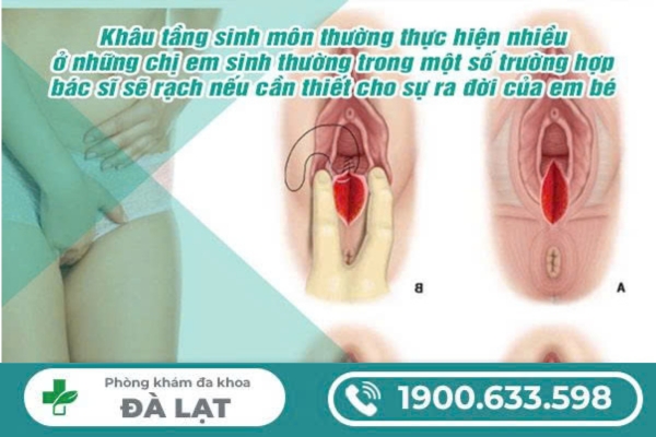 Hình ảnh minh họa