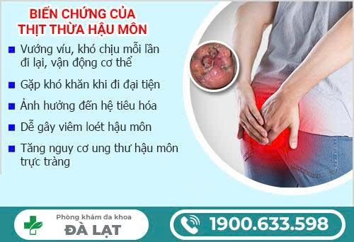 Hình ảnh minh họa