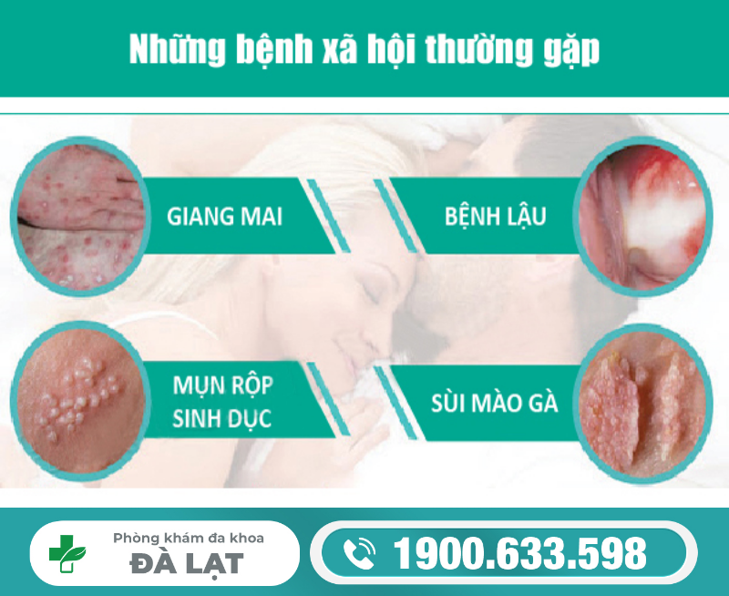 Hình ảnh minh họa