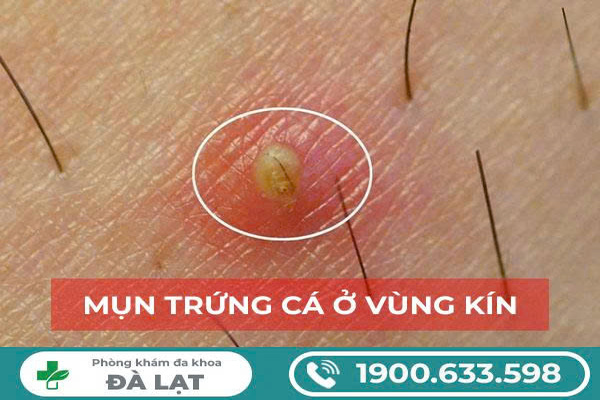 Hình ảnh minh họa