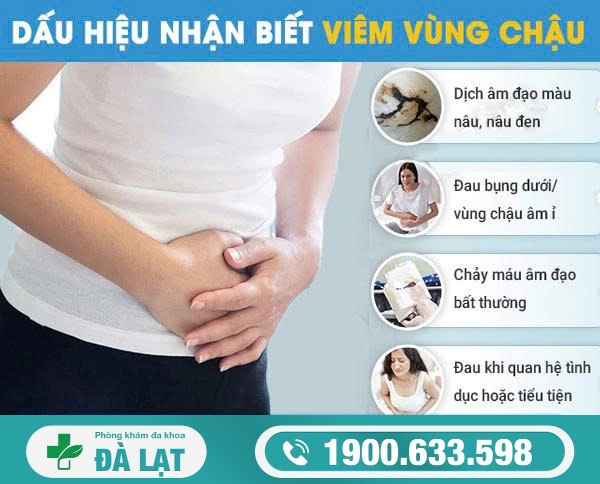 Hình ảnh minh họa