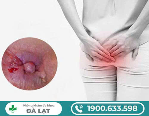 Hình ảnh minh họa