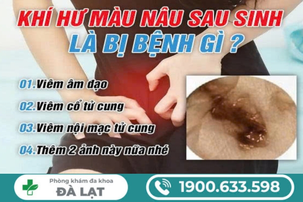 Hình ảnh minh họa