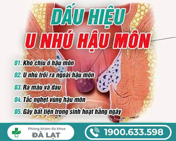 Hình ảnh minh họa