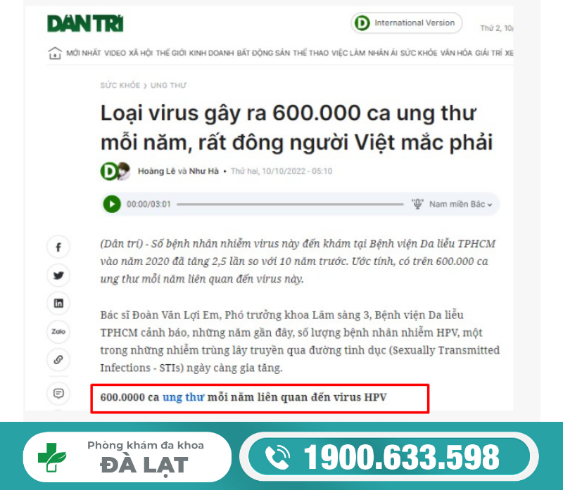 Hình ảnh minh họa