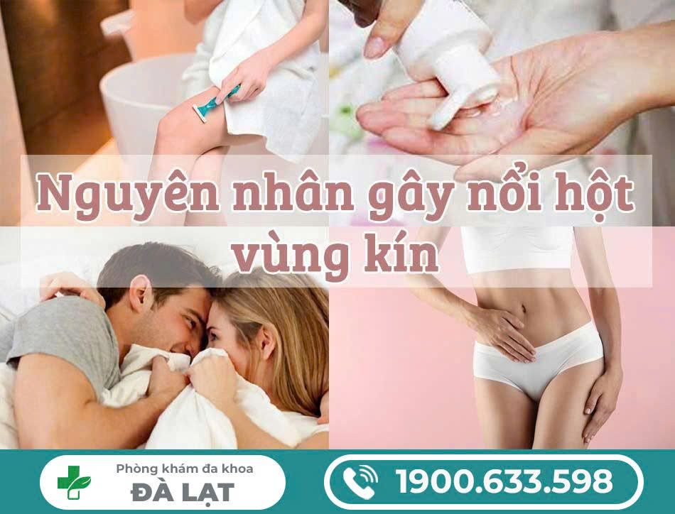 Hình ảnh minh họa