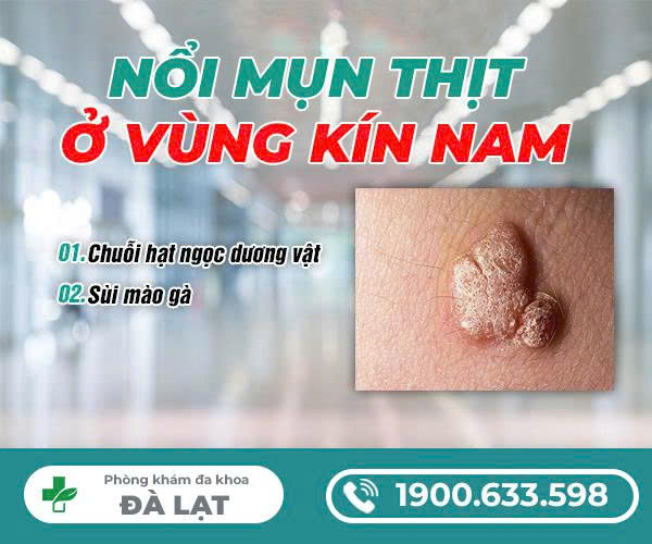 Hình ảnh minh họa