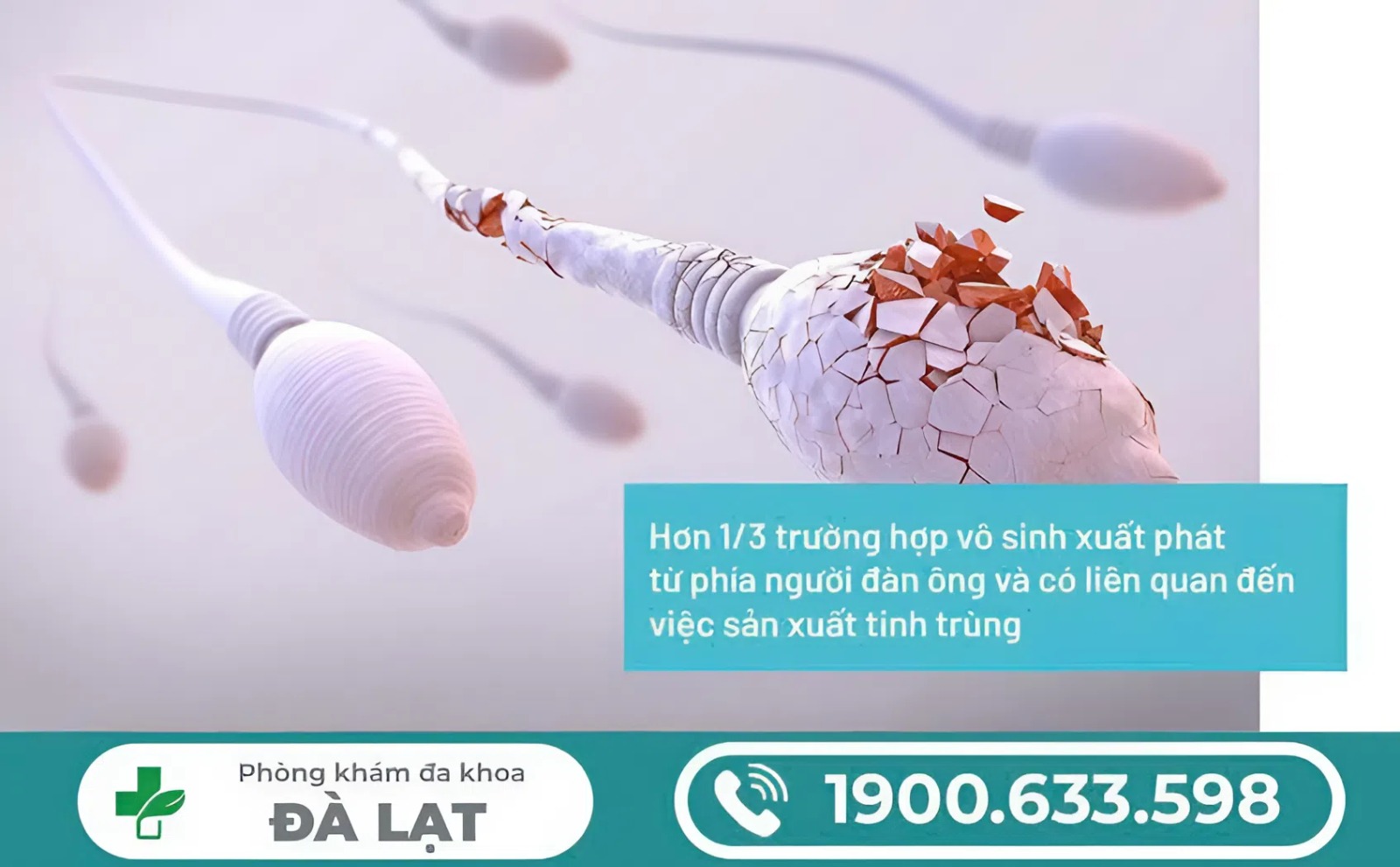 Hình ảnh minh họa