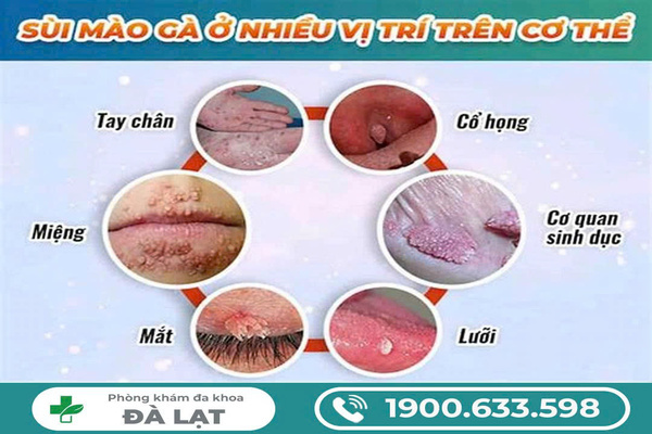 Hình ảnh minh họa