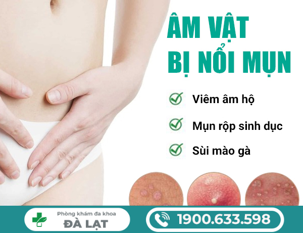 Hình ảnh minh họa