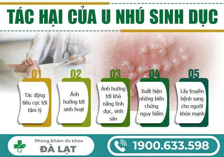 Hình ảnh minh họa