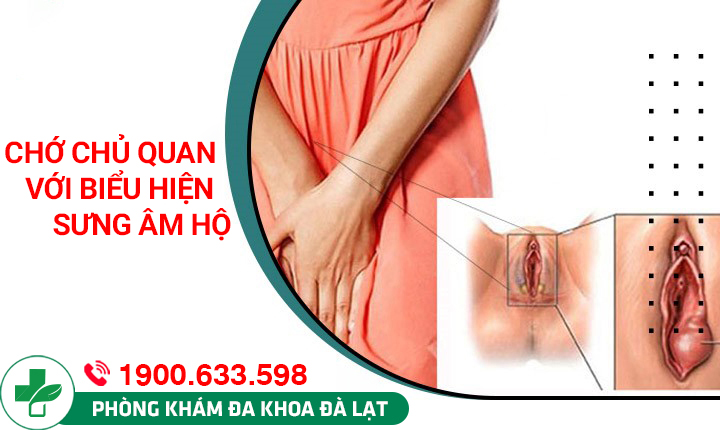 Hình ảnh minh họa